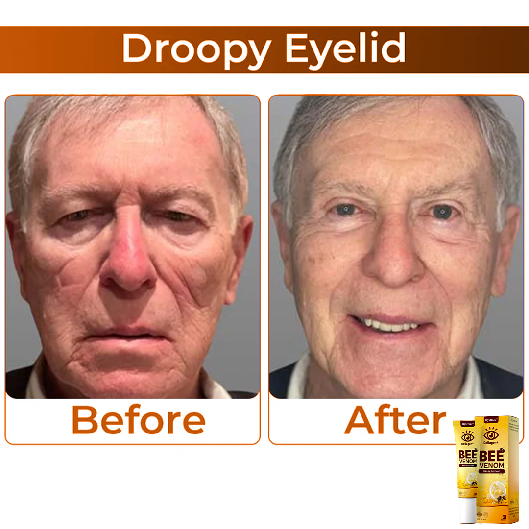 Včelí jed + kolagen: Probuďte svůj pohled
